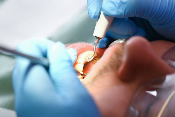 Best Emergency Care for Gum Disease in Santa Ynez, CA