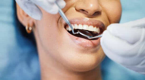 Best Dental Abscess Treatment in Santa Ynez, CA